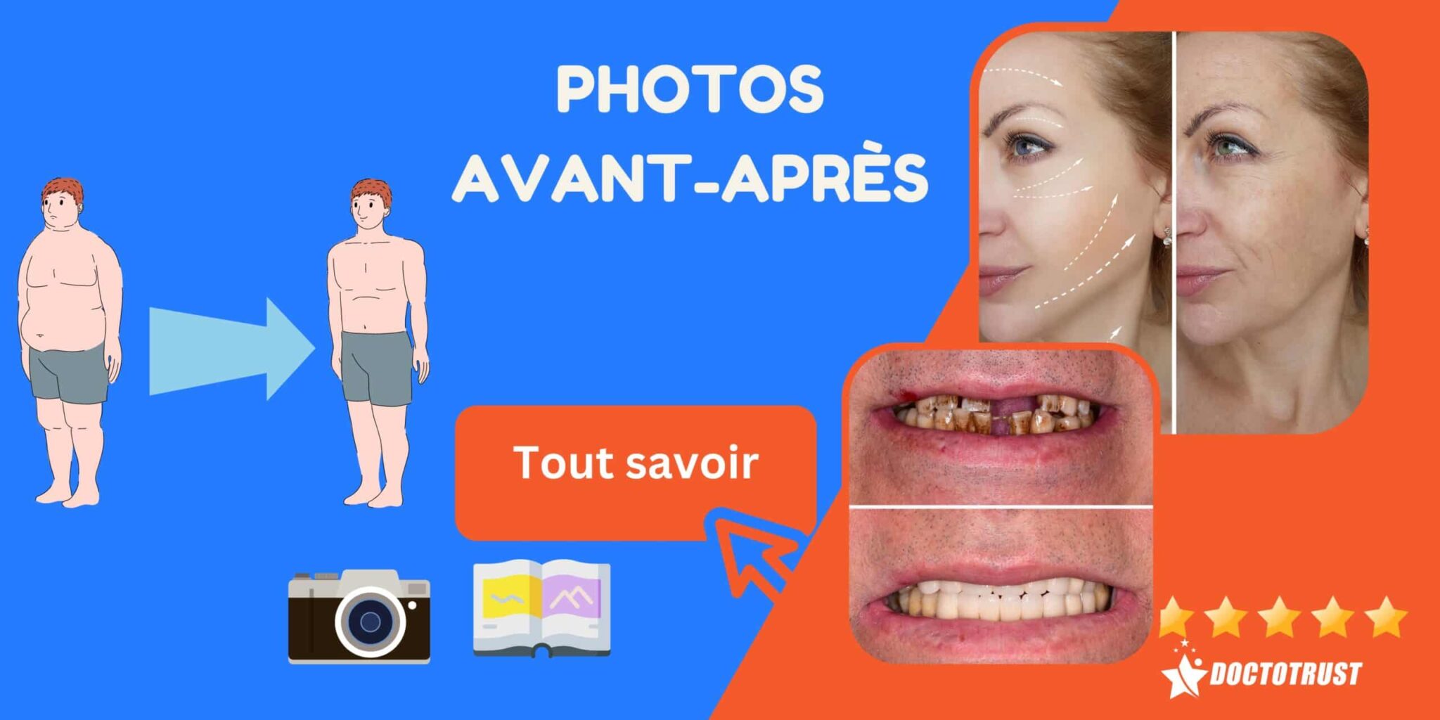 Limportance Des Photos Avant Et Après En Médecine 6381