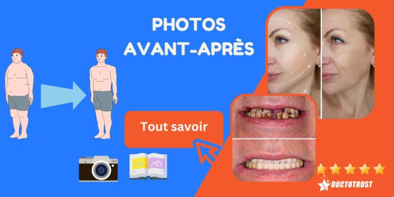 photo avant apres scaled 1